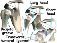 shoulder-biceps-tendonitis