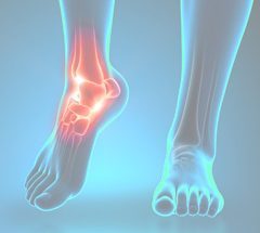 ProOrtho Ankle Specialties