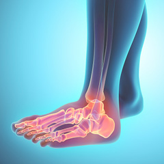 Foot - Proliance ProOrtho Orthopedics Sport, Joints & Spine