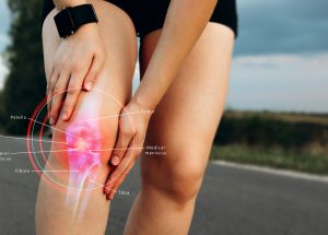 Knee Pain & Meniscus Tears